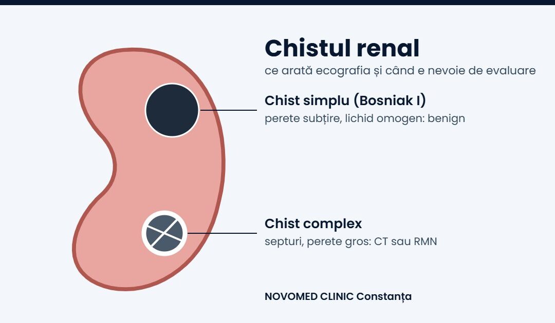 Chistul renal: ce înseamnă, când este periculos și cum se urmărește
