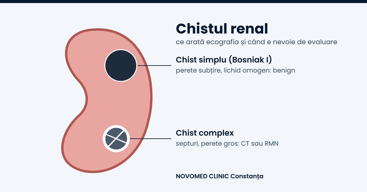 Schemă a unui rinichi cu un chist simplu rotund și un chist complex cu septuri