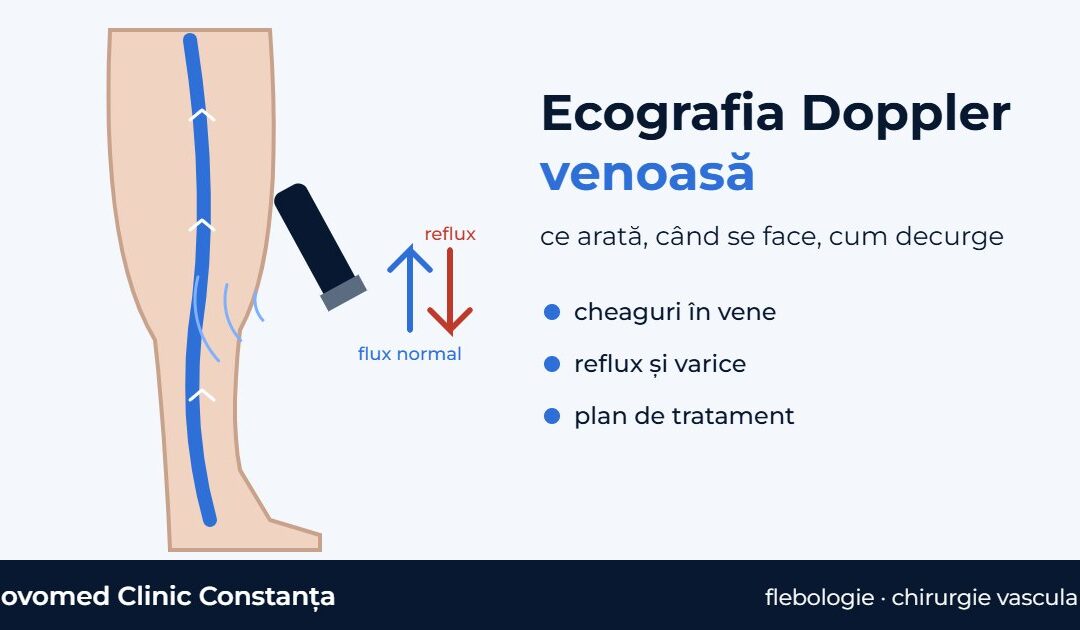 Ecografia Doppler venoasă a picioarelor: ce arată, când se face și cum decurge