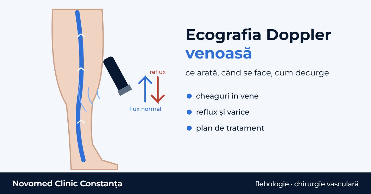 Ilustrație schematică: picior cu o venă albastră și valve, sondă de ecografie și săgeți pentru fluxul normal și reflux