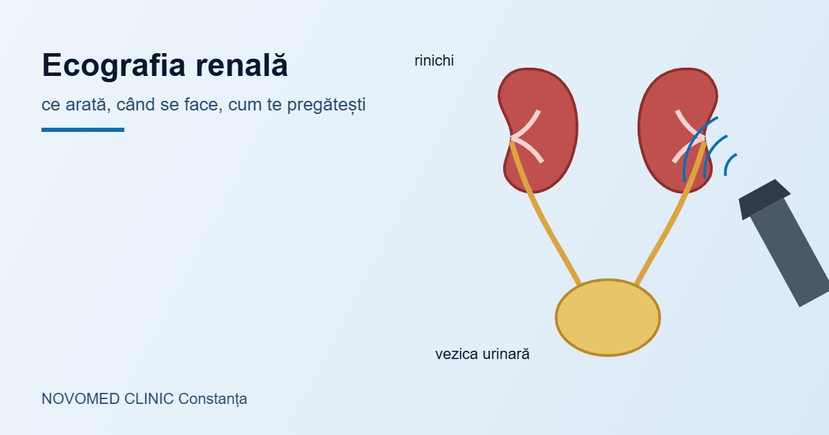 Ilustrație schematică: rinichii, ureterele și vezica urinară, cu o sondă de ecografie care examinează rinichiul drept