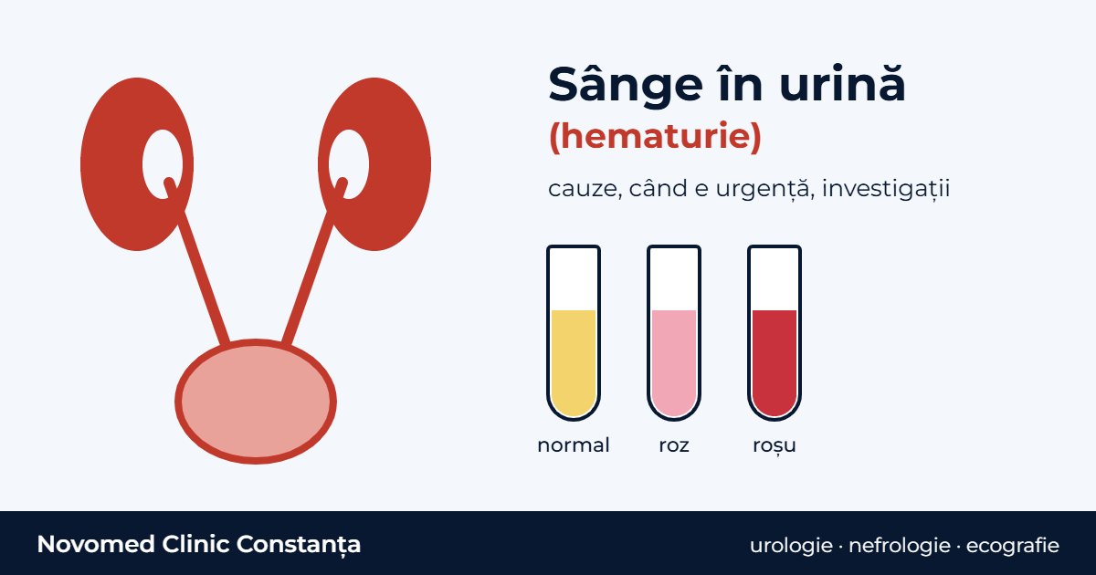 Ilustrație schematică: rinichi, uretere și vezică urinară, alături de trei eprubete cu urină galbenă, roz și roșie
